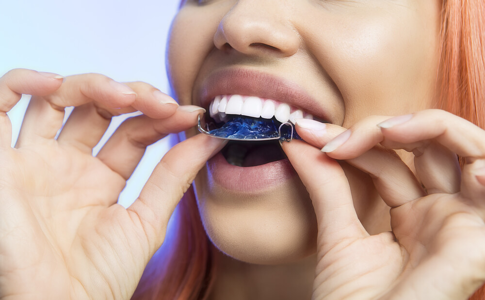 Ghizlane | Blog | Ortodontik Tedavide Hastanın Sorumlulukları